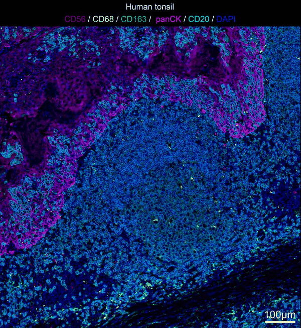 Human tonsil